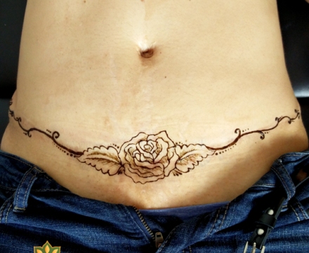 tummy_tuck_scar_coverup_tattoo_orlando